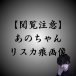 【閲覧注意】あのちゃんリスカ痕画像！メンヘラ？病気？キャラ？衝撃の過去も公開