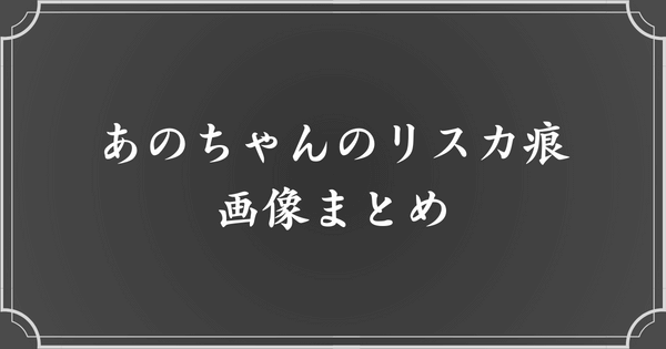 あのちゃんのリスカ痕（リストカットの痕）画像まとめ